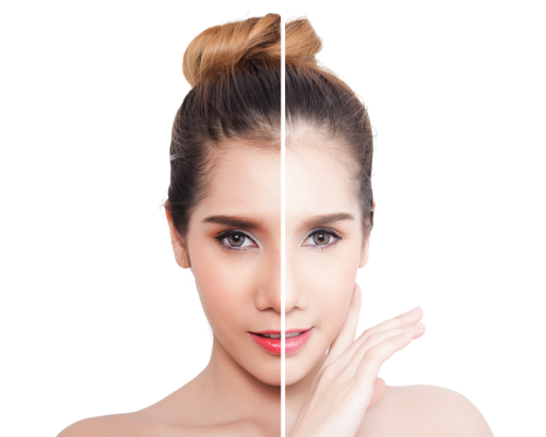 Darkout- wybielanie- ekstrakt z Hypoxis Rooperi oraz Caesalpinia Spinosa Eco